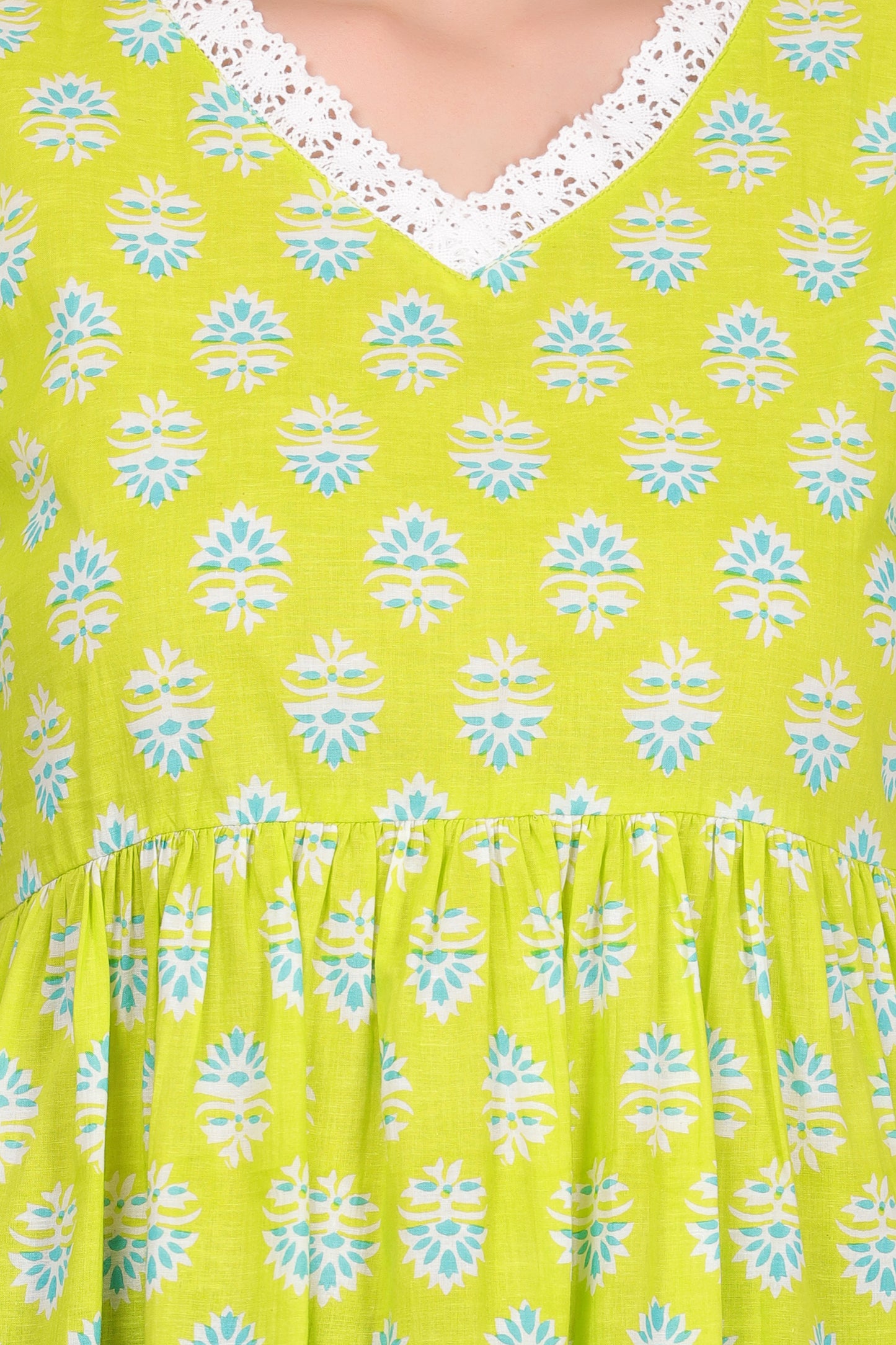 lime lace (tunic top)